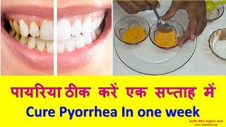 पायरिया ठीक करें एक सप्ताह में  Cure Pyorrhea In one week [upl. by Grantley]