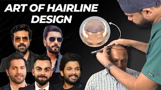 Hair Transplant In Pune  Natural Looking Hairline  Understanding Mens Hairline  hairloss [upl. by Sabina409]