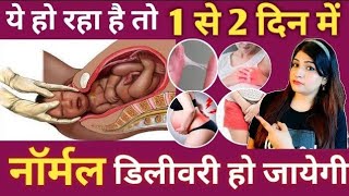 Symptoms Of Labour Pain In Hindi l प्रसव शुरू होने के लक्षण l Signs Of Labour Pain In Hindi [upl. by Elly]