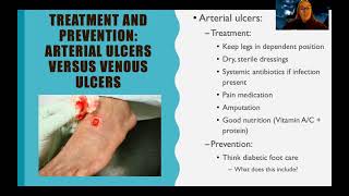 Med Surg Vascular Disorders EXTENDED VERSION [upl. by Naltiac815]