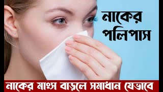 Nose Polyps Treatment Bangla  নাকের পলিপাস দূর করার উপায় । POLYMED [upl. by Emilie]