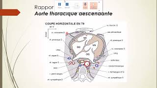 7  Aorte et Artère pulmonaire 6 [upl. by Allimac]