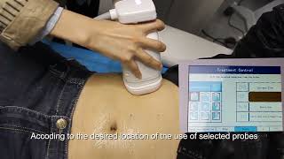 Liposonix hifu Machine body slimming procedure  liposonix hifu body sculpting Case in action [upl. by Aernda]