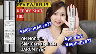 REVIEW Reedle Shot 100  VT Cosmetic  Pake skin care yang ada microneedle nya Apa gak sakit tuh [upl. by Norahs]