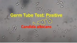 Germ Tube Test Positive Candida [upl. by Wellington]