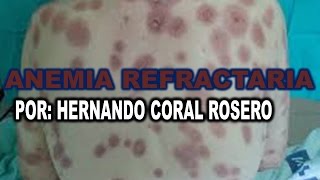 ANEMIA REFRACTARIA  ANOMALIA DE CÉLULAS SANGUINEAS [upl. by Anoo]