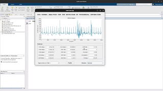 ECG Signal Analysis for the Detection of Myocardial Infarction [upl. by Edea66]