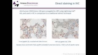 Immunohistochemistry Webinar An Introduction to Immunohistochemistry [upl. by Hezekiah]