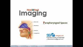 lmaging of Parapharyngeal spaces DRE Prof Mamdouh Mahfouz [upl. by Hillari641]