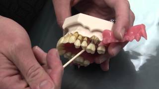 What is Periodontal Disease [upl. by Brinna]