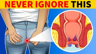 6 Signs of Colon Cancer You Should Know [upl. by Petracca]