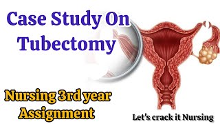 Case Study On Tubectomy Nursing 3rd Year AssignmentCommunity Health Nursing Lets Crack it Nursing [upl. by Sethrida]