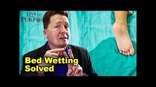 How To Stop Bed Wetting  Nocturnal Enuresis [upl. by Gordy]