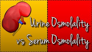 Urine Osmolality vs Serum Osmolality Hyponatraemia [upl. by Wendeline332]