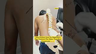 Scoliosis treatment by DrRavi scoliosistreatment chiropractic spine fitness india physio [upl. by Nilecoj]