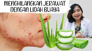 DIY Aloe Vera untuk Jerawat  Cara Pakai Lidah Buaya dirumah  dr Emasuperr [upl. by Radley]