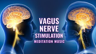 Vagus Nerve Stimulation Frequency  Rewire Your Brain From Anxiety  Vagal Tone to Heal Vagus Nerve [upl. by Avigdor548]