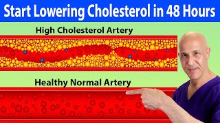 Start Lowering Your Cholesterol Naturally Within 48 Hours Dr Mandell [upl. by Zebulen422]