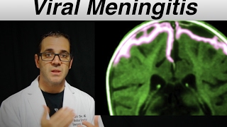 viral meningitis  Patient Education Video [upl. by Arbba531]