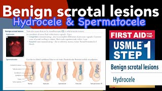 Benign scrotal lesions Hydrocele amp Spermatocele in HindiUrdu by first aid for USMLE step 1 [upl. by Rikahs]