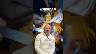 Anterior Knee Pain  What Does It Mean shorts [upl. by Tristam]