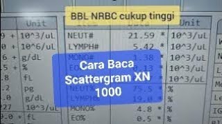 Cara Baca Scattergram Histogram Hematology Analyzer 6 Diff XN 1000 [upl. by Acinoj301]