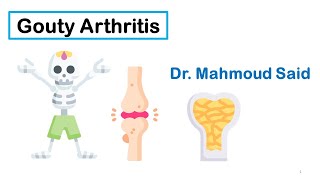 Bone Disorders 1 Gouty Arthritis النقرس [upl. by Alacim]