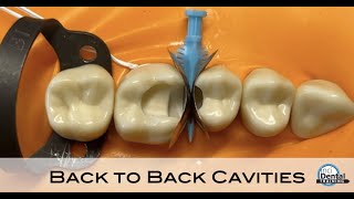 Back to Back Cavity Tutorial [upl. by Eldoria]