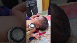 hydrocephalus newborn hydrocephalusbaby congenitalanomaly [upl. by Byrann]