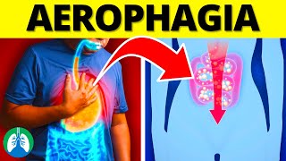 Aerophagia Medical Definition  Quick Explainer Video [upl. by Eenert]