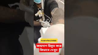 birthmark remove price in BD  how to do remove price mark in Dhaka [upl. by Nerret]