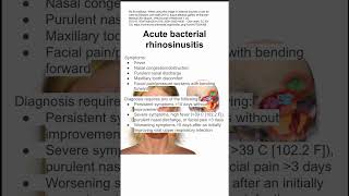 Acute bacterial rhinosinusitis [upl. by Elburt]