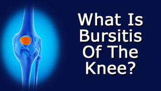 What Is Bursitis Of The Knee [upl. by Cathrin]