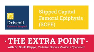 Slipped Capital Femoral Epiphysis SCFE  The Extra Point with Dr Scott Kleppe [upl. by Nawak]