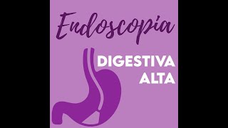 Endoscopia Digestiva Alta  como é feito e para que serve esse exame [upl. by Anirtruc]