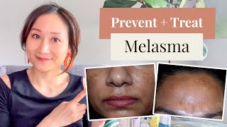 Dermatologists Guide to Melasma  Preventing  Treating  Dr Jenny Liu [upl. by Borlow]