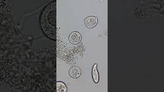 Paramecium and Ciliates 100x  800x Magnification science microscope 19 [upl. by Jodie]