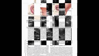 Libro de Ecografía Obstétrica y Ginecológica [upl. by Latashia]