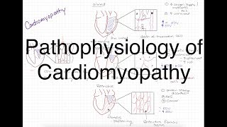 Pathophysiology of Cardiomyopathy [upl. by Miof Mela13]