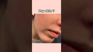 How to get rid of dry skin dry skin shorts trending viral skincare tips fyp [upl. by Smiley]