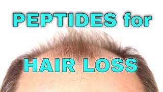 Peptides for Hair Loss [upl. by Glassco]