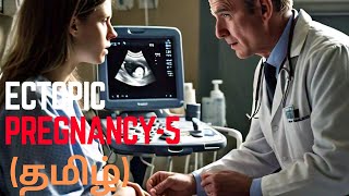 Ectopicpregnancy part 5 காரணம் Etiology implantationoutside uterine cavity fertility baby [upl. by Sualkin]