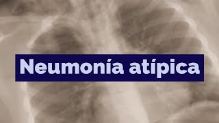 ¿Qué es la neumonía atípica [upl. by Mojgan]