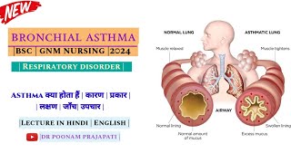 Asthma cause sign amp symptoms treatment asthma  gnm 2 year bronchial asthma  nursing lecture MSN [upl. by Clintock]