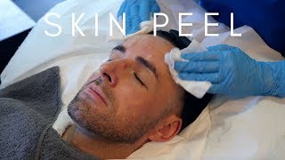 Skin Peel Obagi Blue Peel Radiance at The Laser and Skin Clinic [upl. by Leirud417]