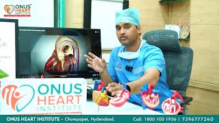 Revolutionizing Heart Valve Care Dr Lakkireddy on Advanced TAVI Procedure at Onus Heart Institute [upl. by Aisnetroh]