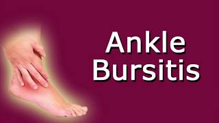 Ankle Bursitis [upl. by Ahsenyl]