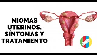 MIOMAS UTERINOS Síntomas y Tratamiento [upl. by Gnivre]