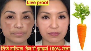 बस 1 चीज़ मिला के झाइयों को जड़ से ख़त्म करें Pigmentation Removal [upl. by Arvid27]