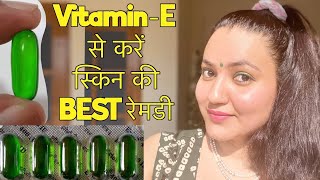 SKIN CHALLENGE इस तरह करें Vitamin E Oil का प्रयोग और पाए गोरी निखरी Healthy स्किन हमेशा के लिए [upl. by Rothberg985]